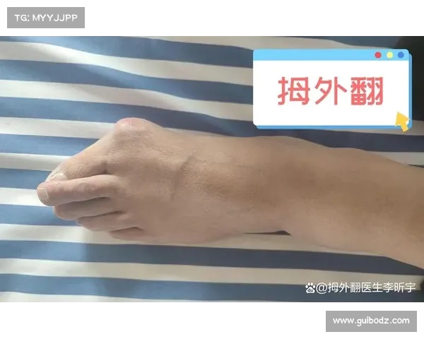 戴维斯右膝敷冰袋无明显跛行自述恢复良好状态 戴维斯右膝敷冰袋无明显跛行自述恢复良好状态